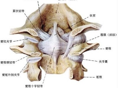 寰枢关节脱位