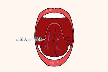 正常舌下静脉图