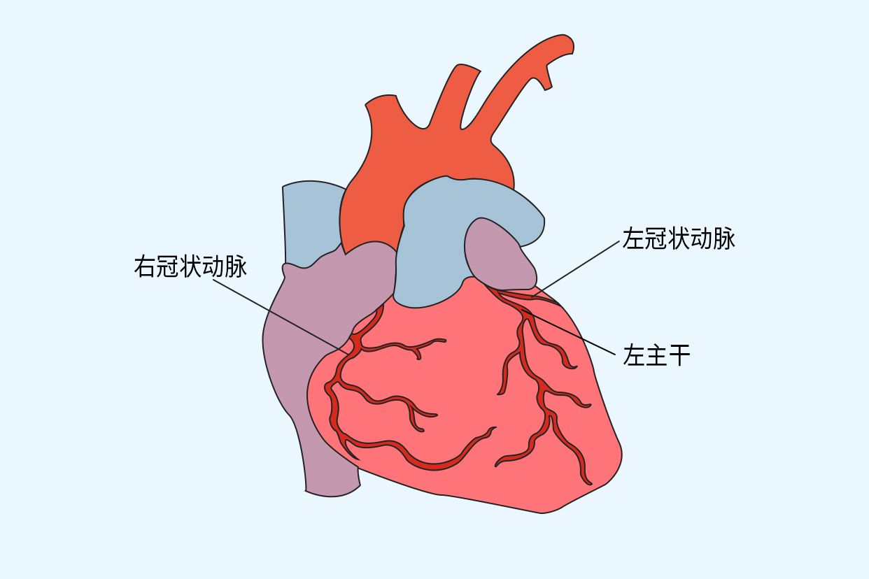 冠状动脉窦口位置图片