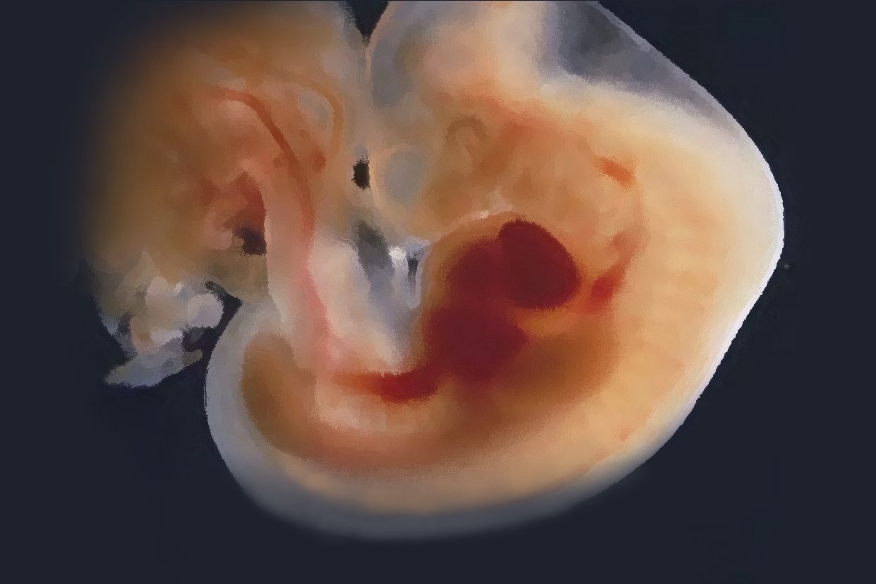 60天女孩胎囊图片图片