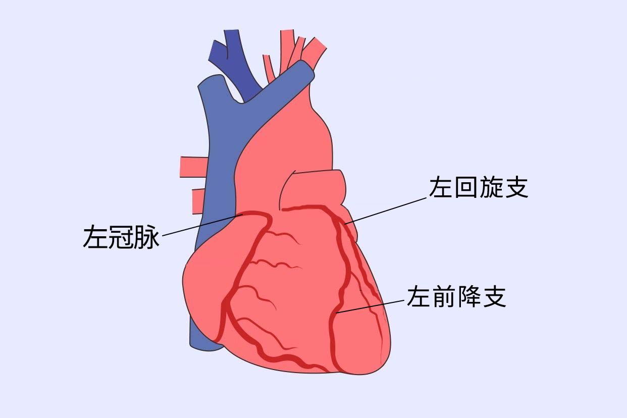 冠状动脉三条分支图