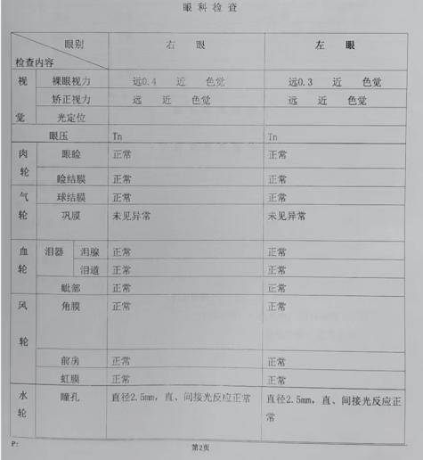 标准对数视力表是如何检查视力的？