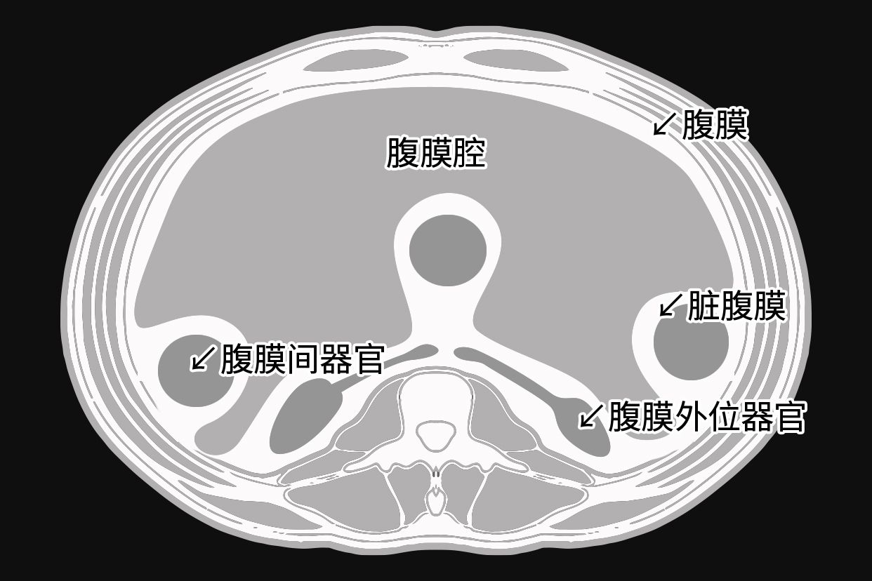 腹膜结构示意图图片