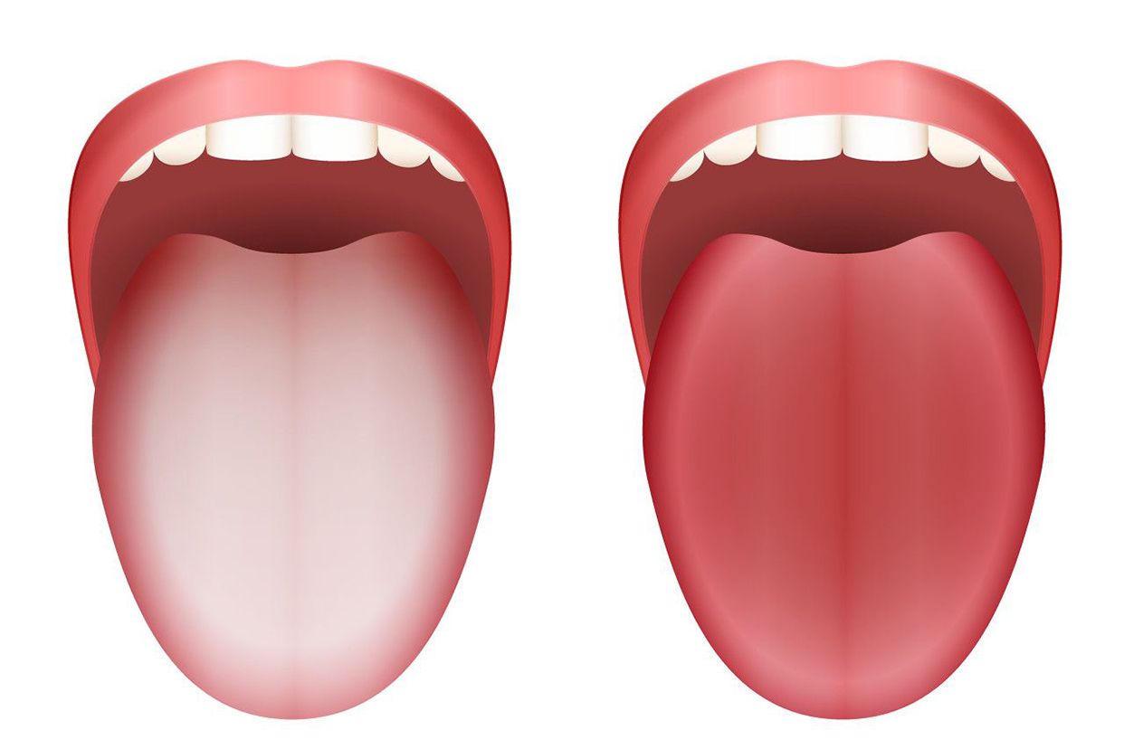 血虚舌苔图片