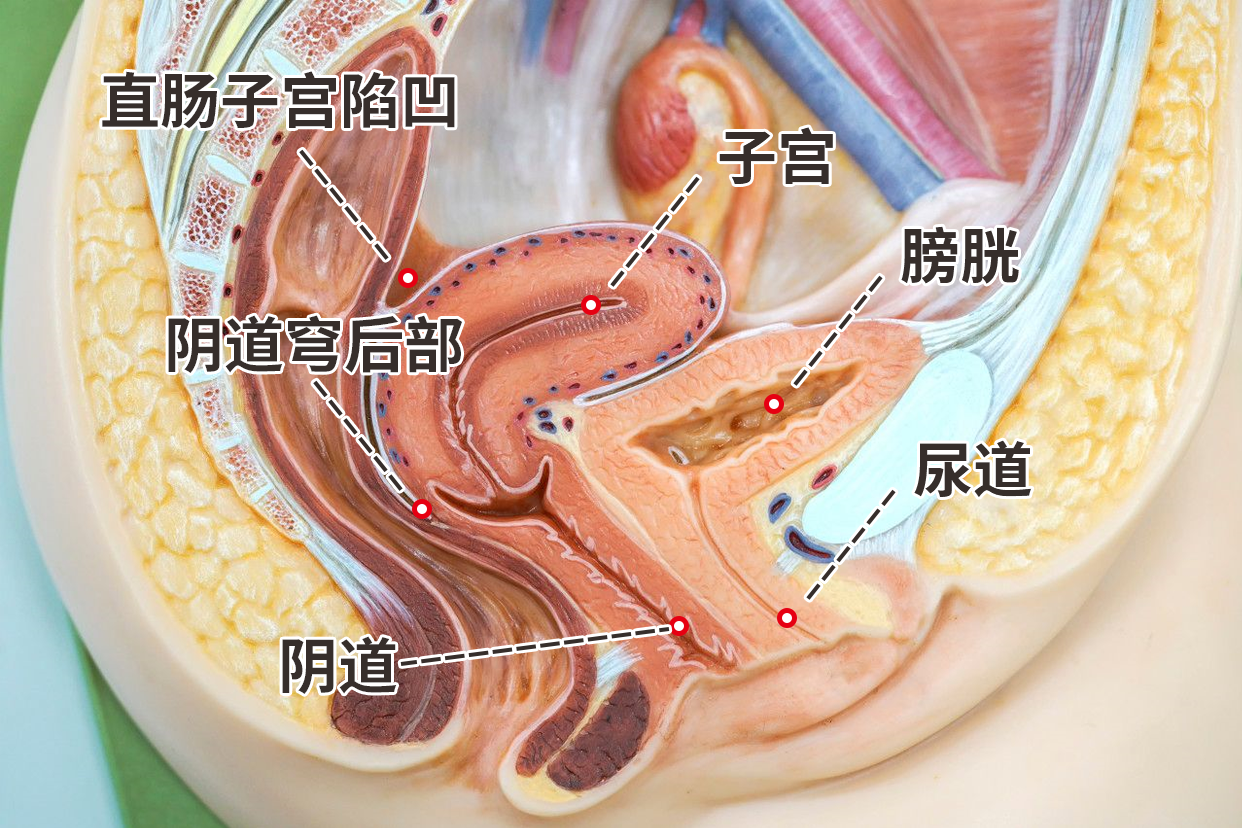 女性尿道外口的位置图片