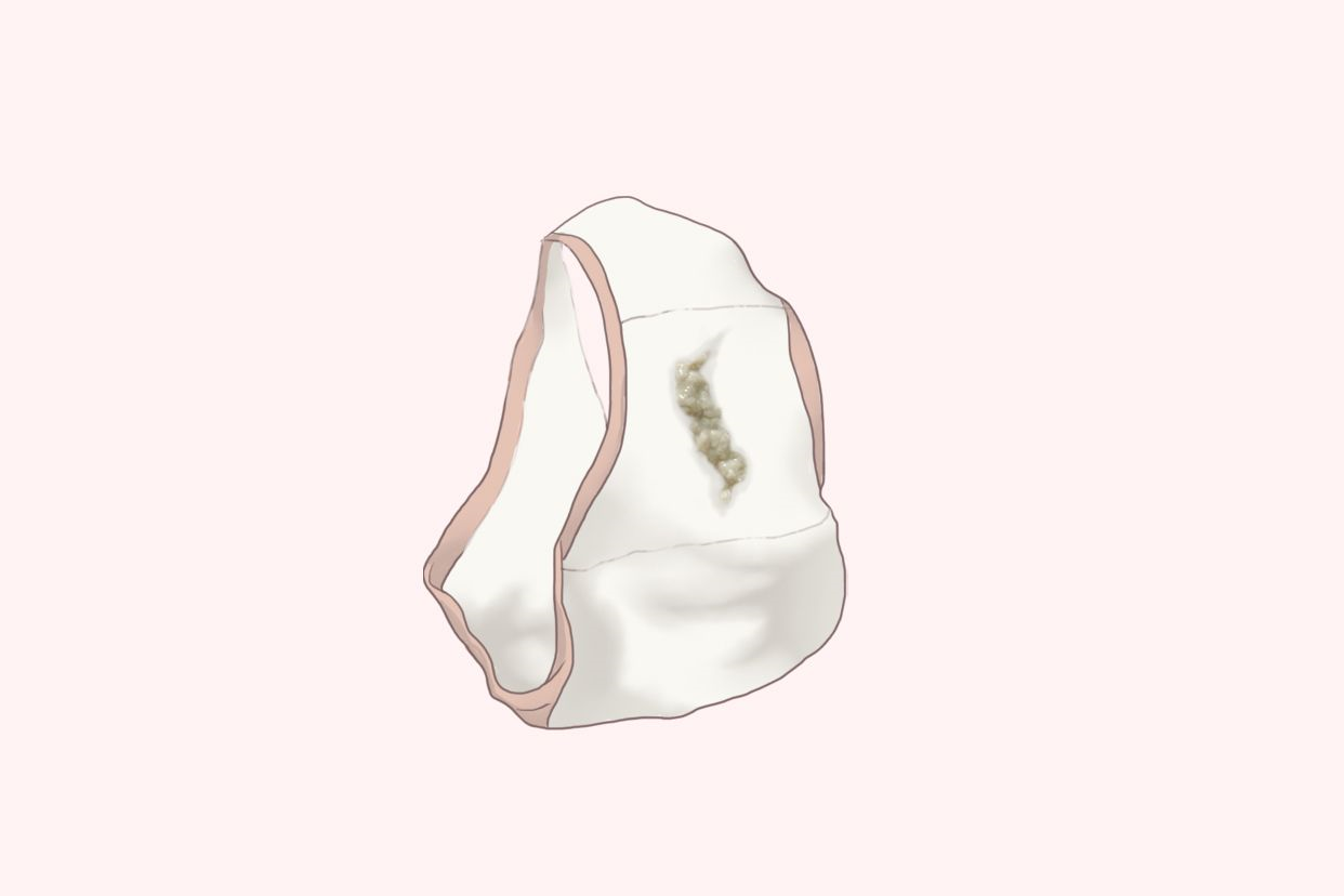 外阴阴道假丝酵母菌病图