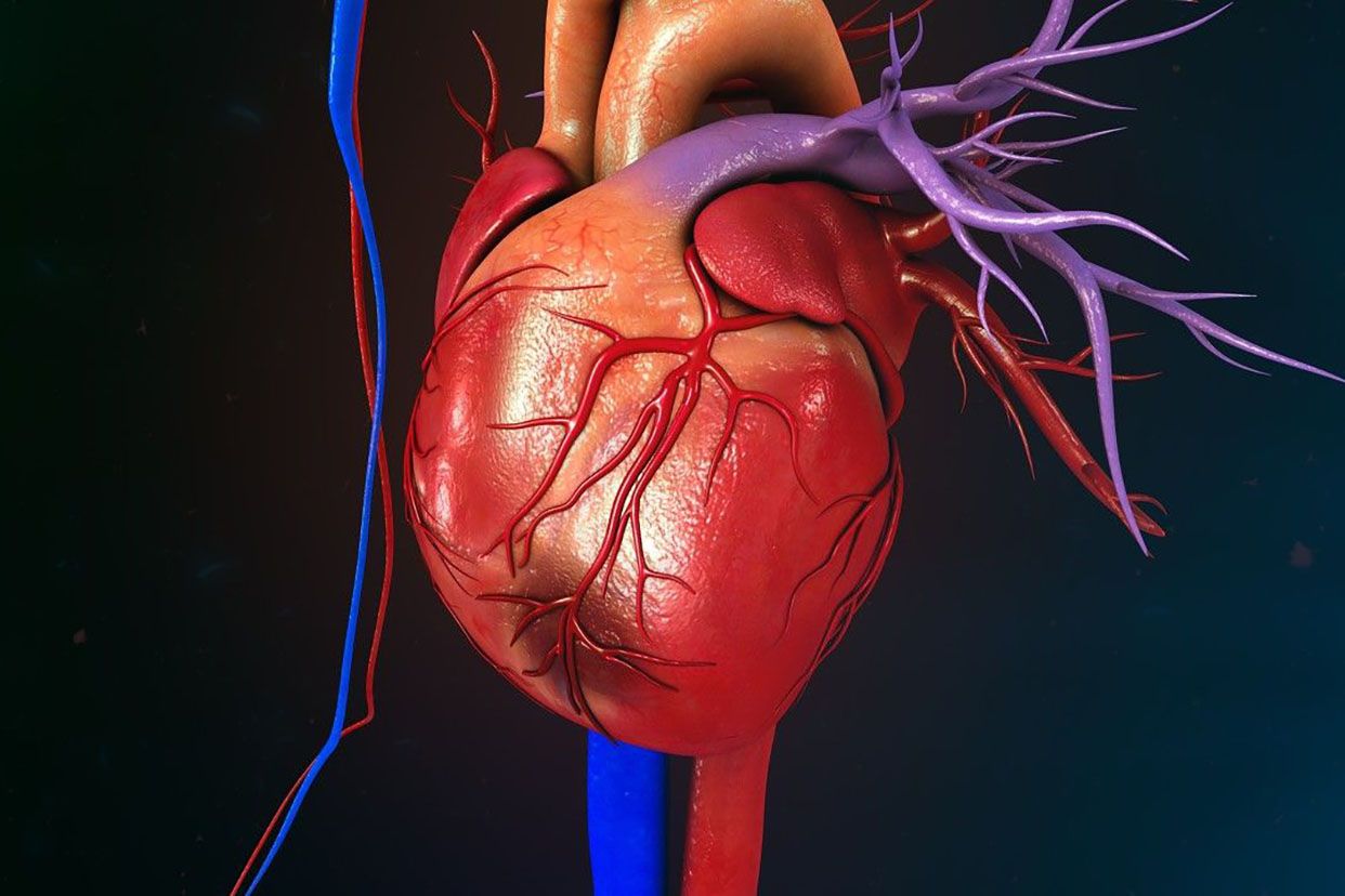 大多是指冠状动脉阻塞,供血不足导致心肌缺血坏死,其中冠状动脉粥样