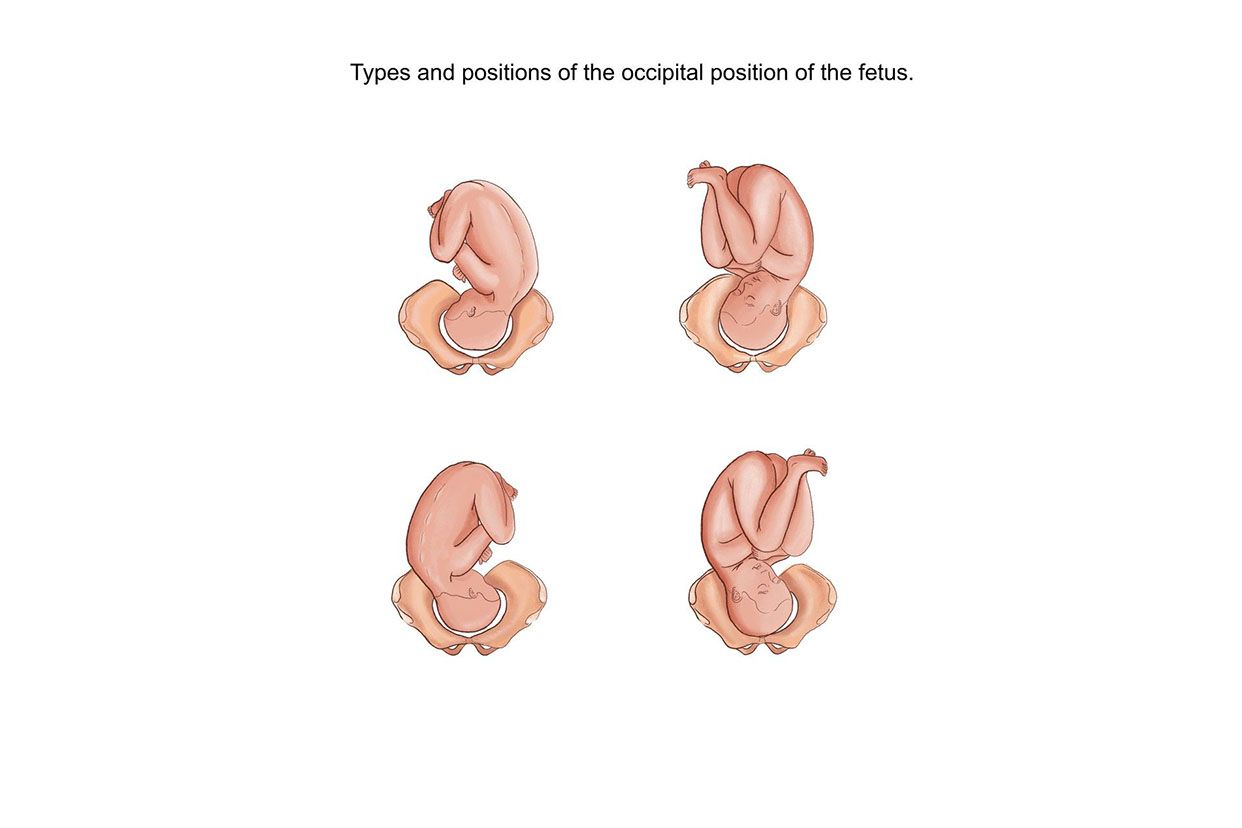 胎位变化图片