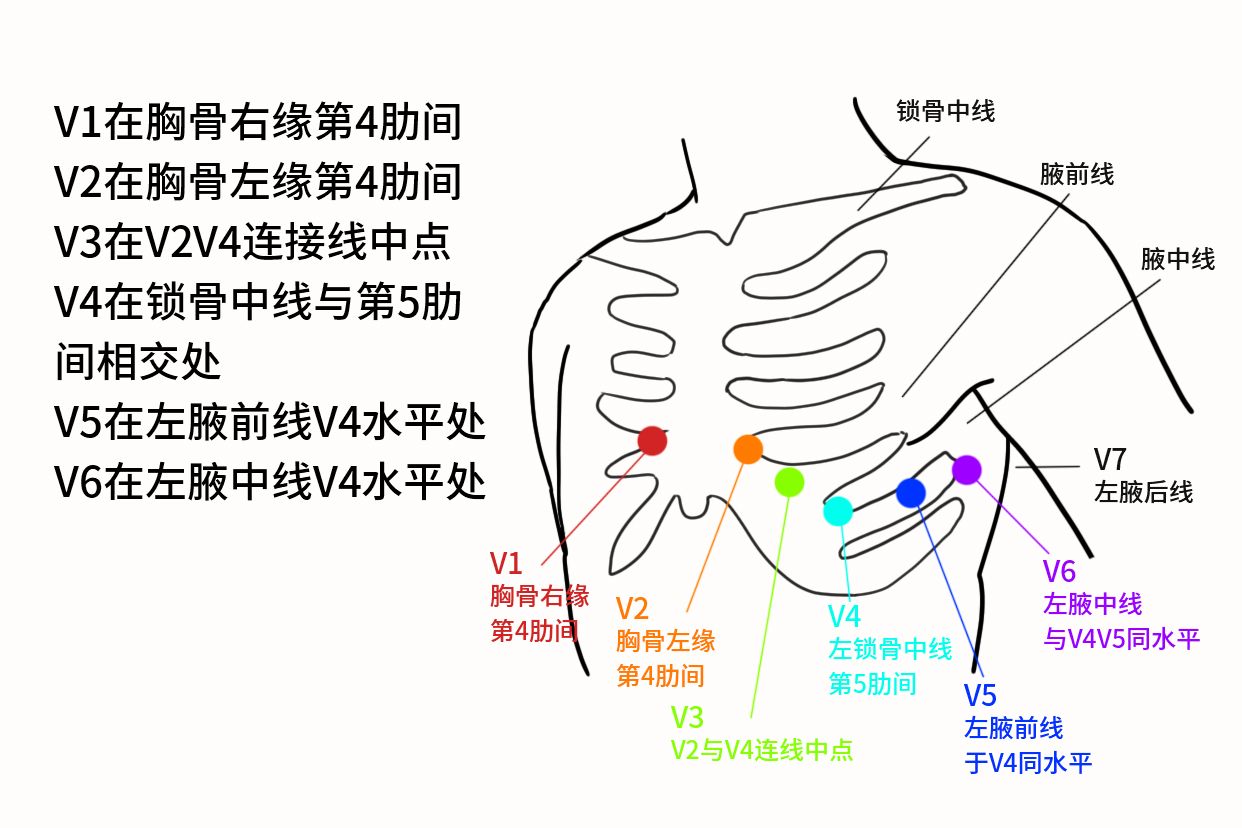 胸前区导联位置图