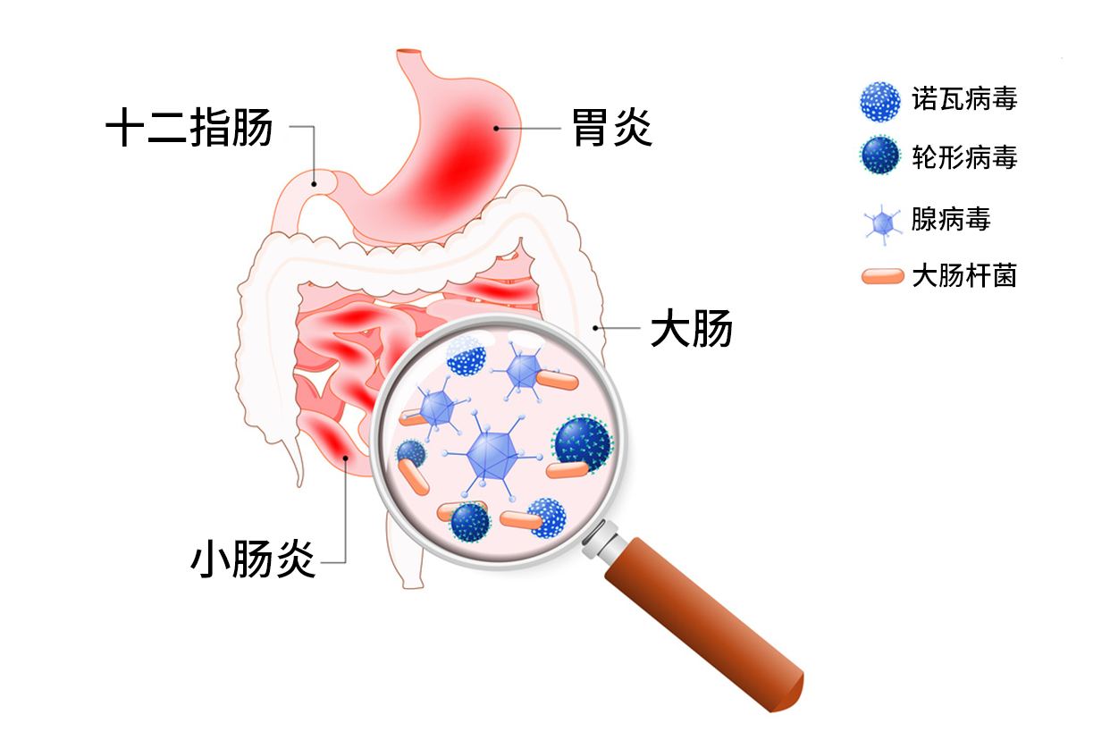 肠胃炎位置图片