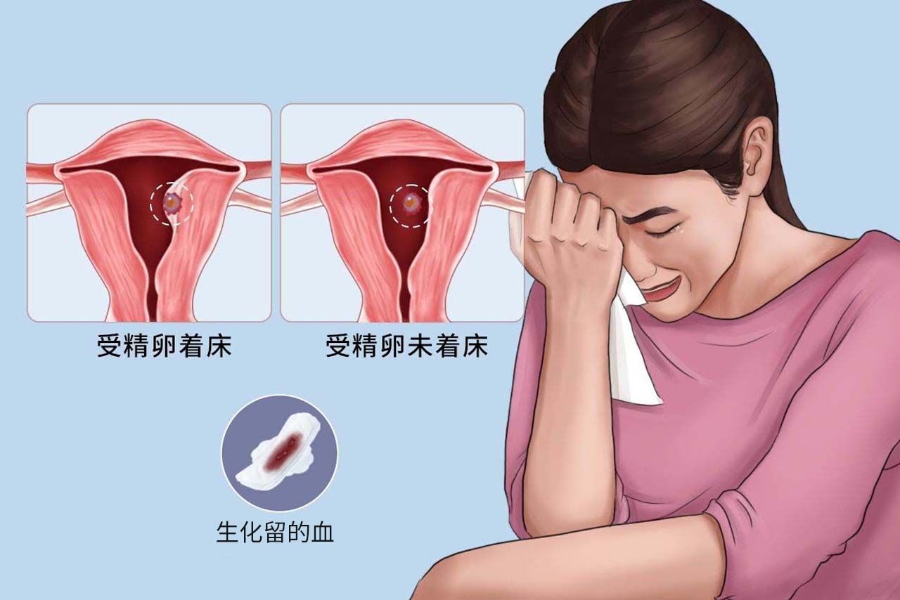 生化妊娠流血图