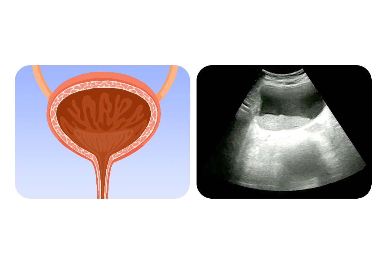 認識膀胱：位置、構造、功能、保養照顧