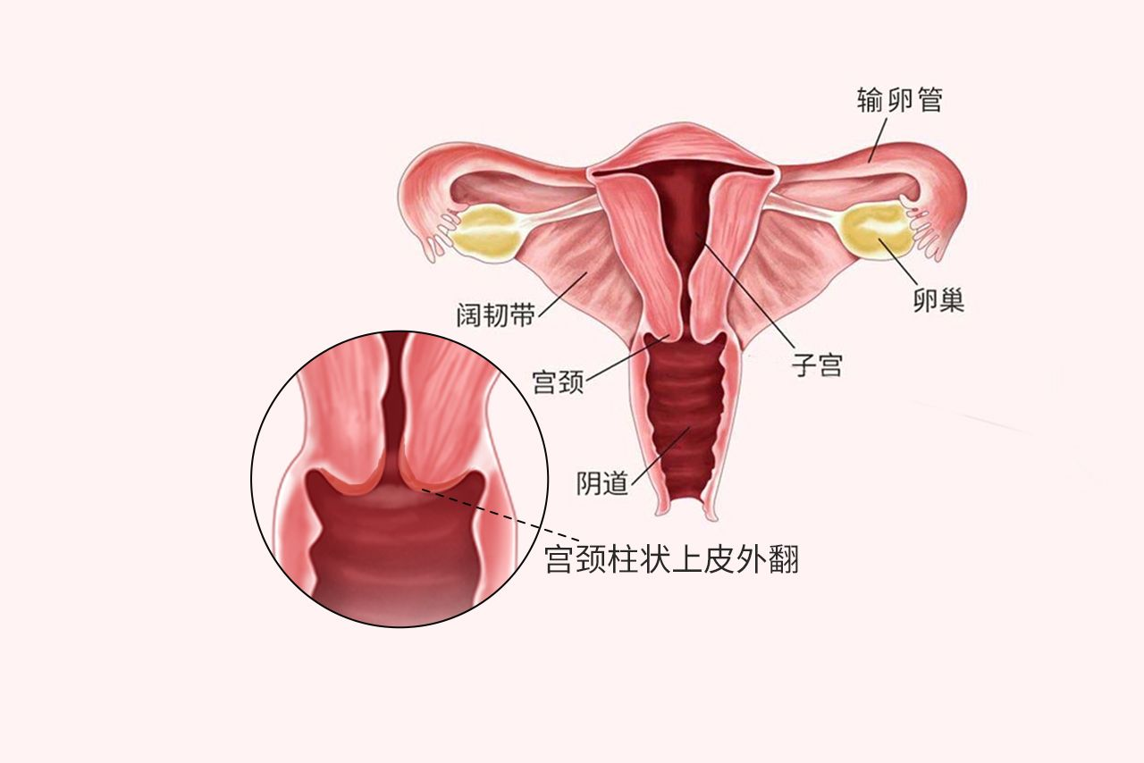 正常宫颈 鳞状上皮图片