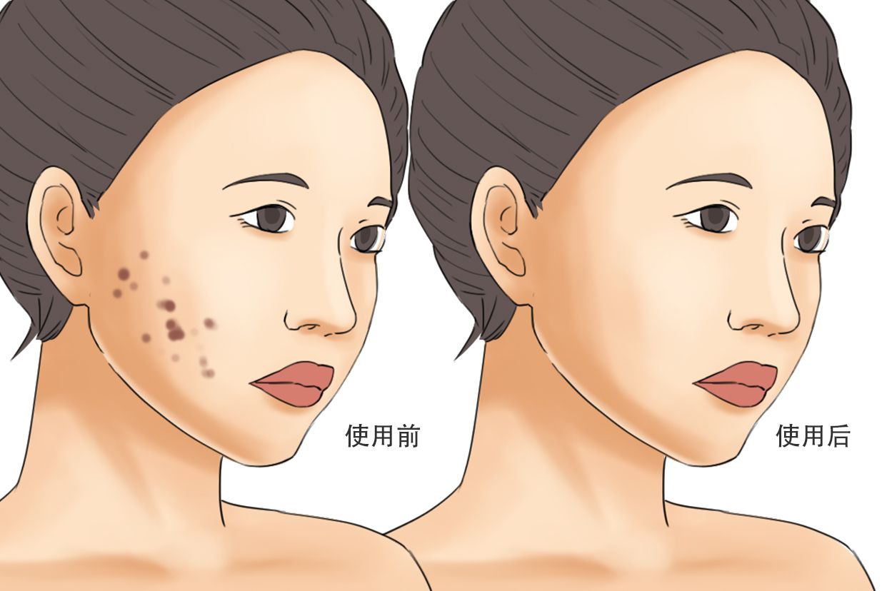 丹芎瘢痕涂膜效果图片