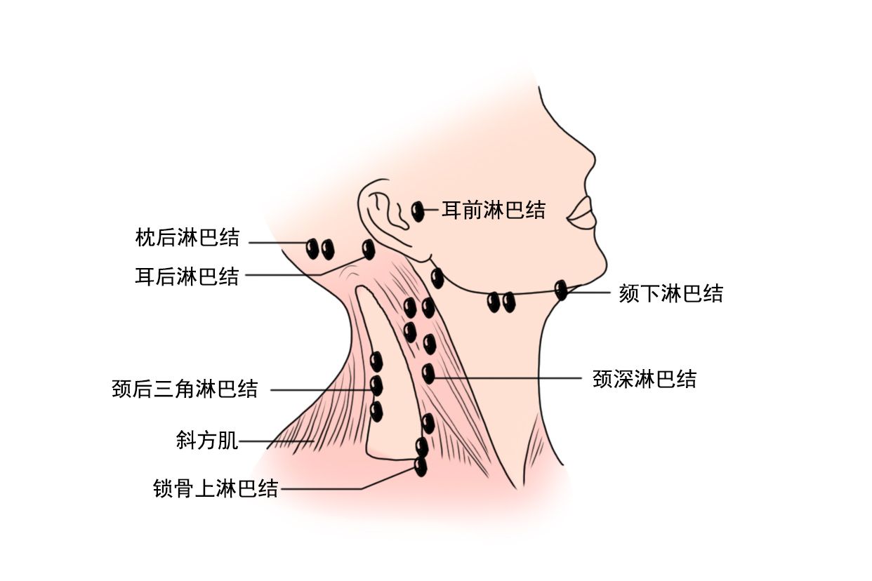 右锁骨上淋巴结位置图