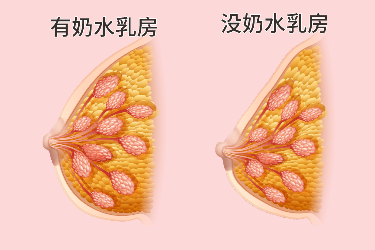 没奶水和有奶水乳房变化图片