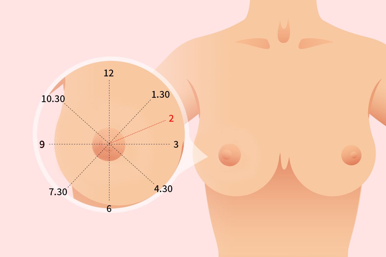 右乳腺2点位置图片