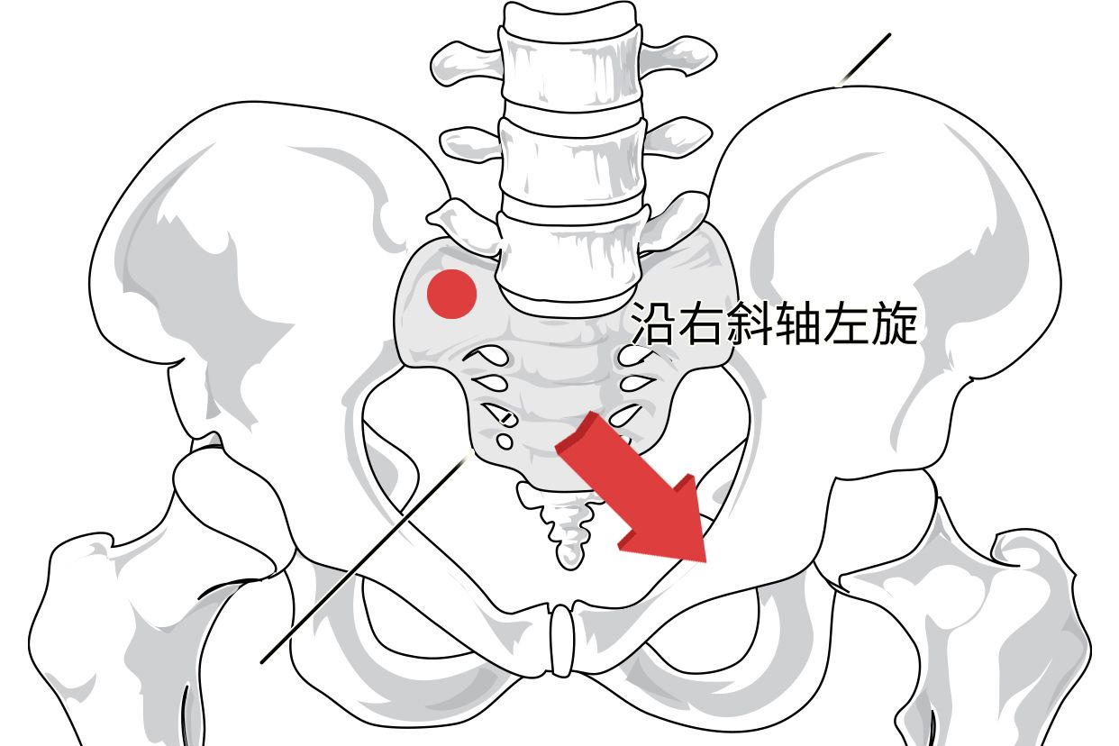 骶骨左旋圖片