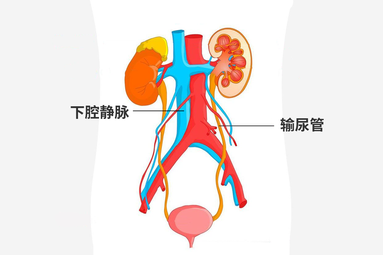 下腔静脉后输尿管图片