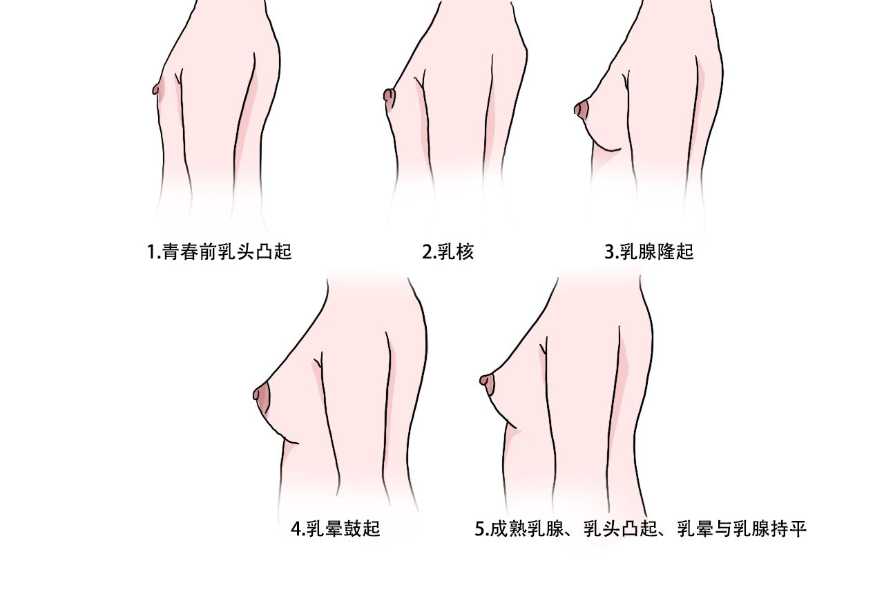 乳房发育五个阶段图