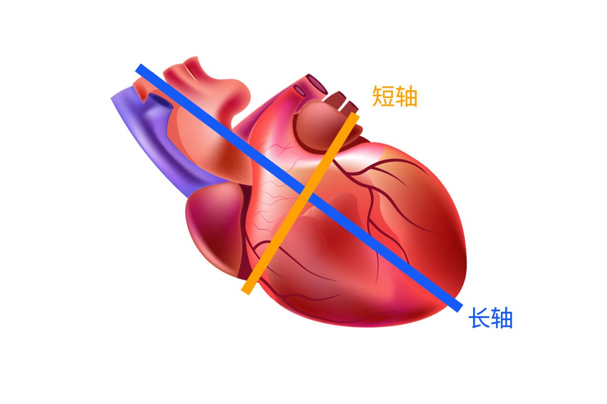 心脏长轴和短轴图解