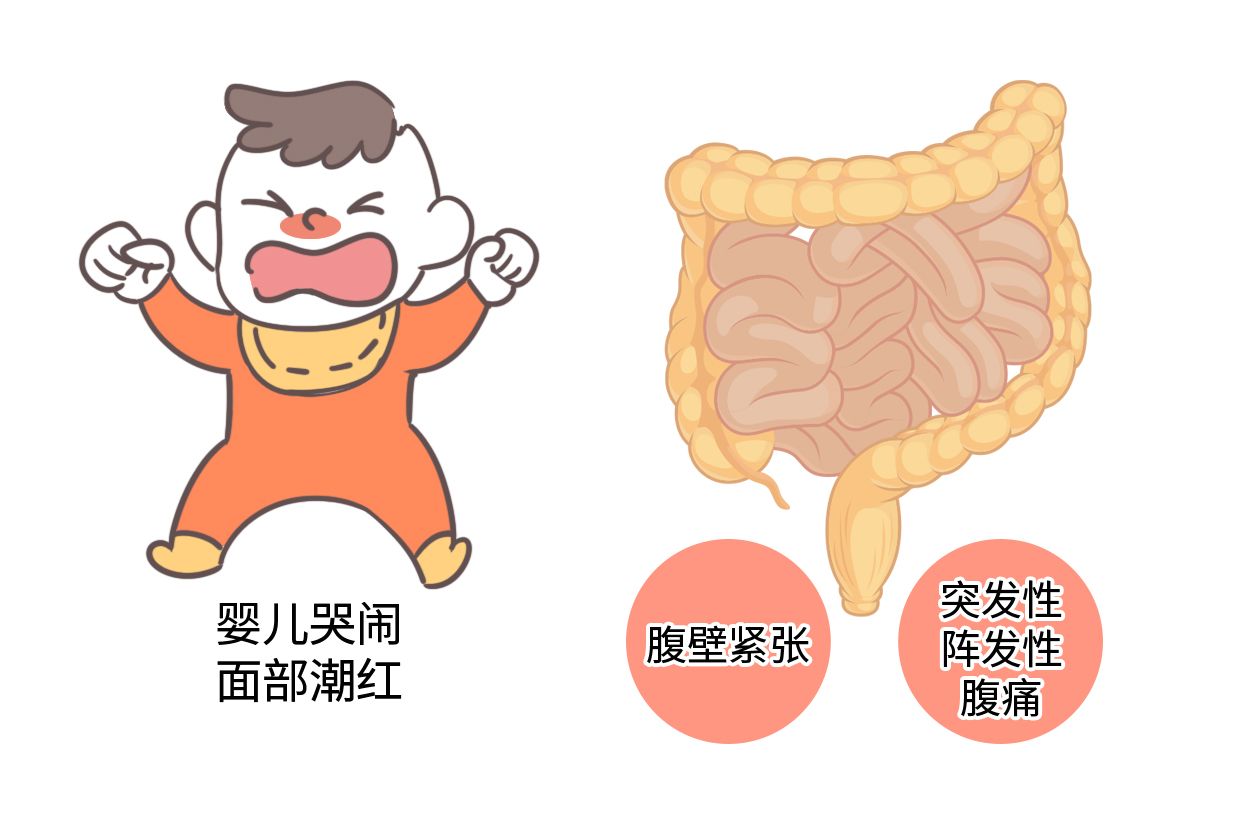 此外,还可以遵医嘱服用药物进行治疗,例如西托溴铵等,有助于缓解肠道