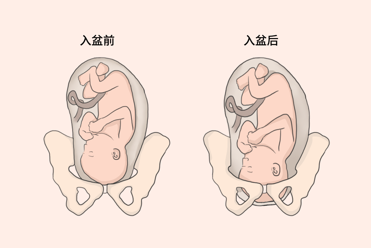 胎宝宝入盆后肚子图片图片