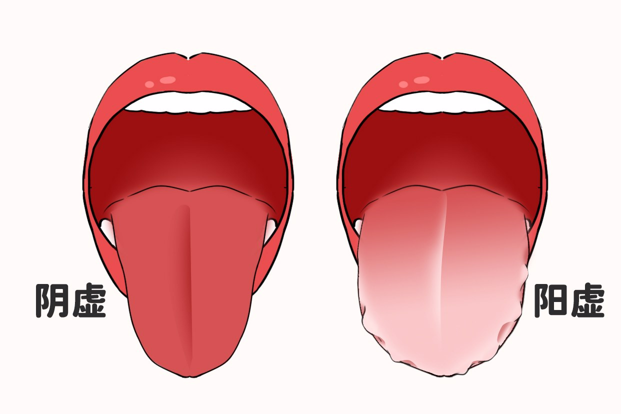 身体虚舌头图片
