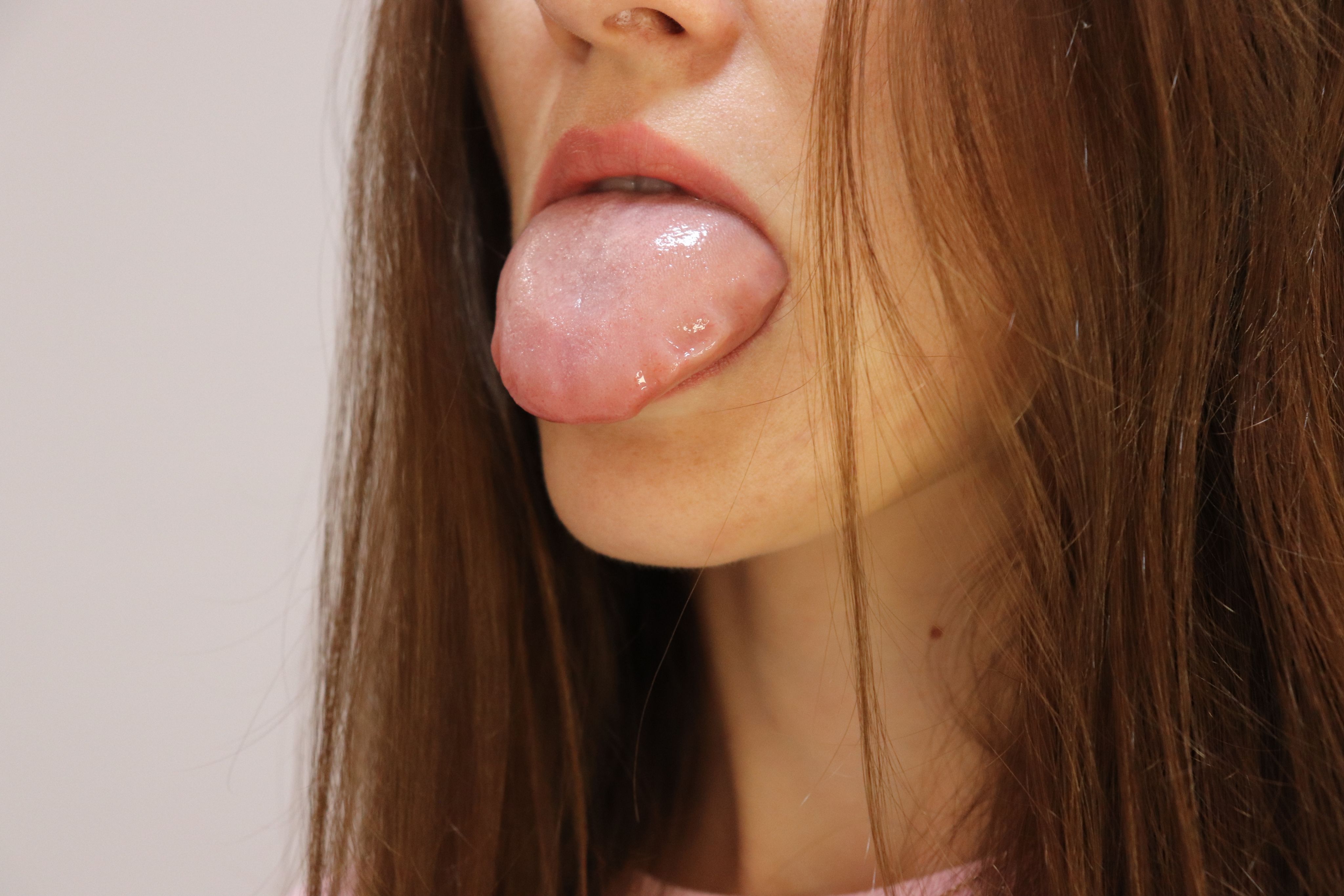 舌体胖大图片