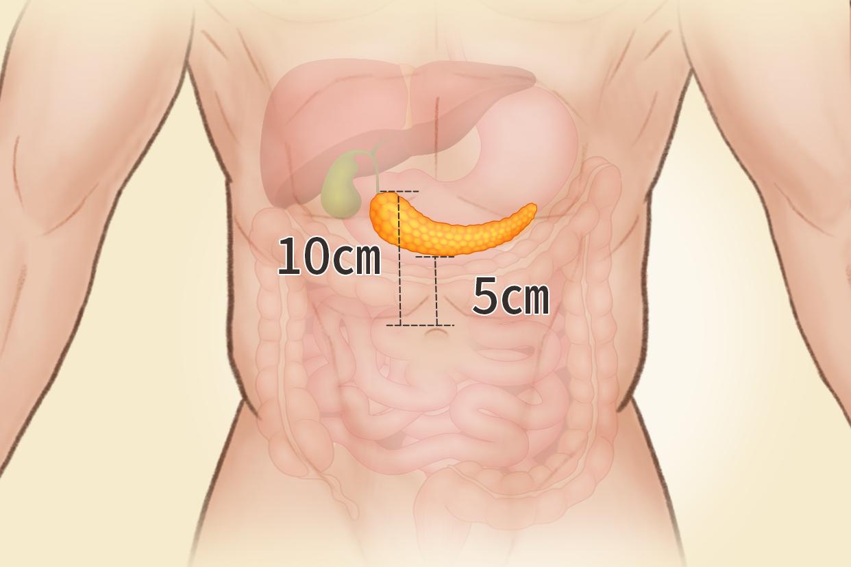 人体胰腺位置图