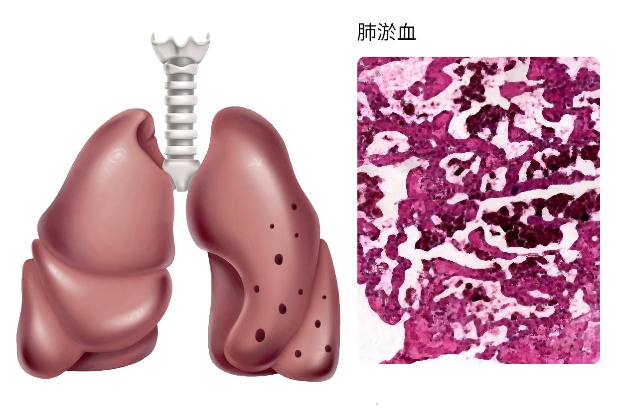 胃痛的位置难受图片