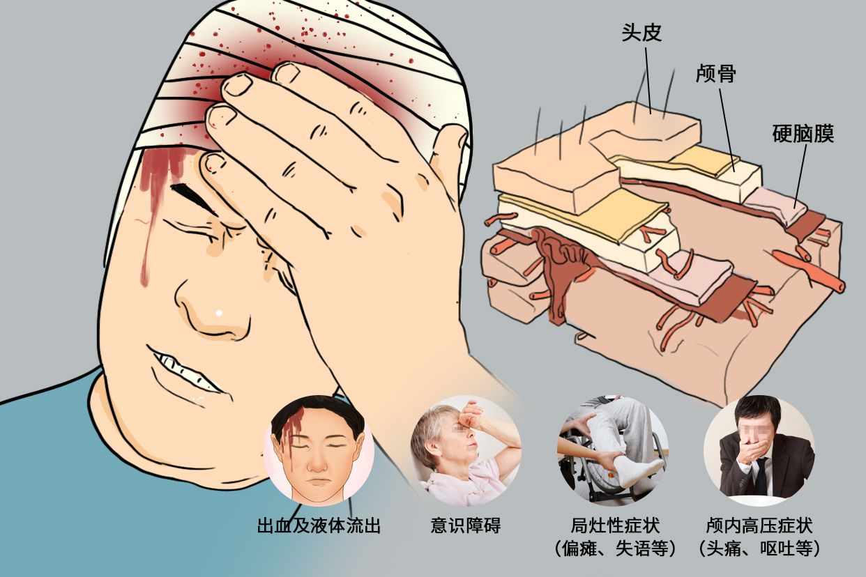 脑损伤卡通图片