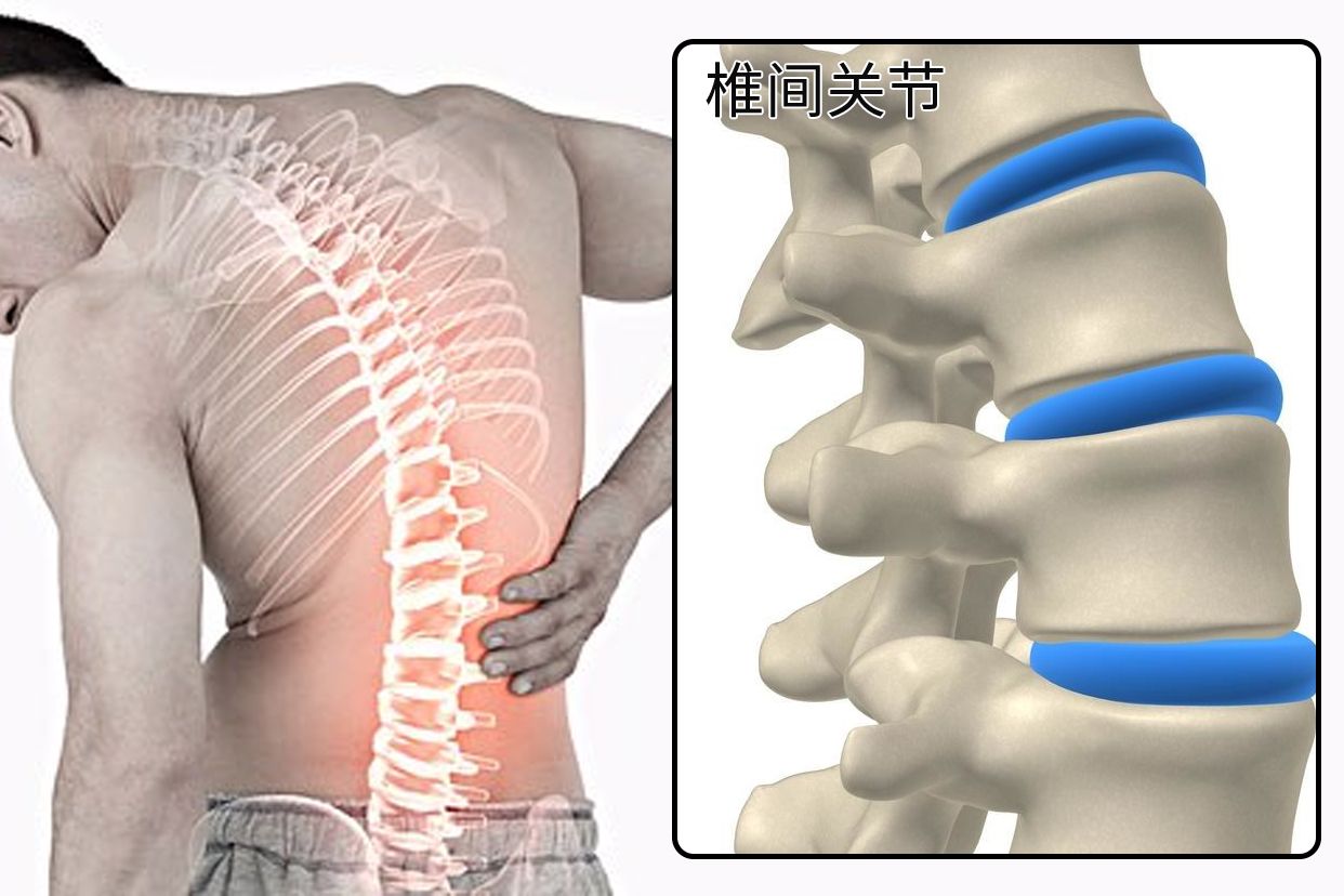 椎间关节图