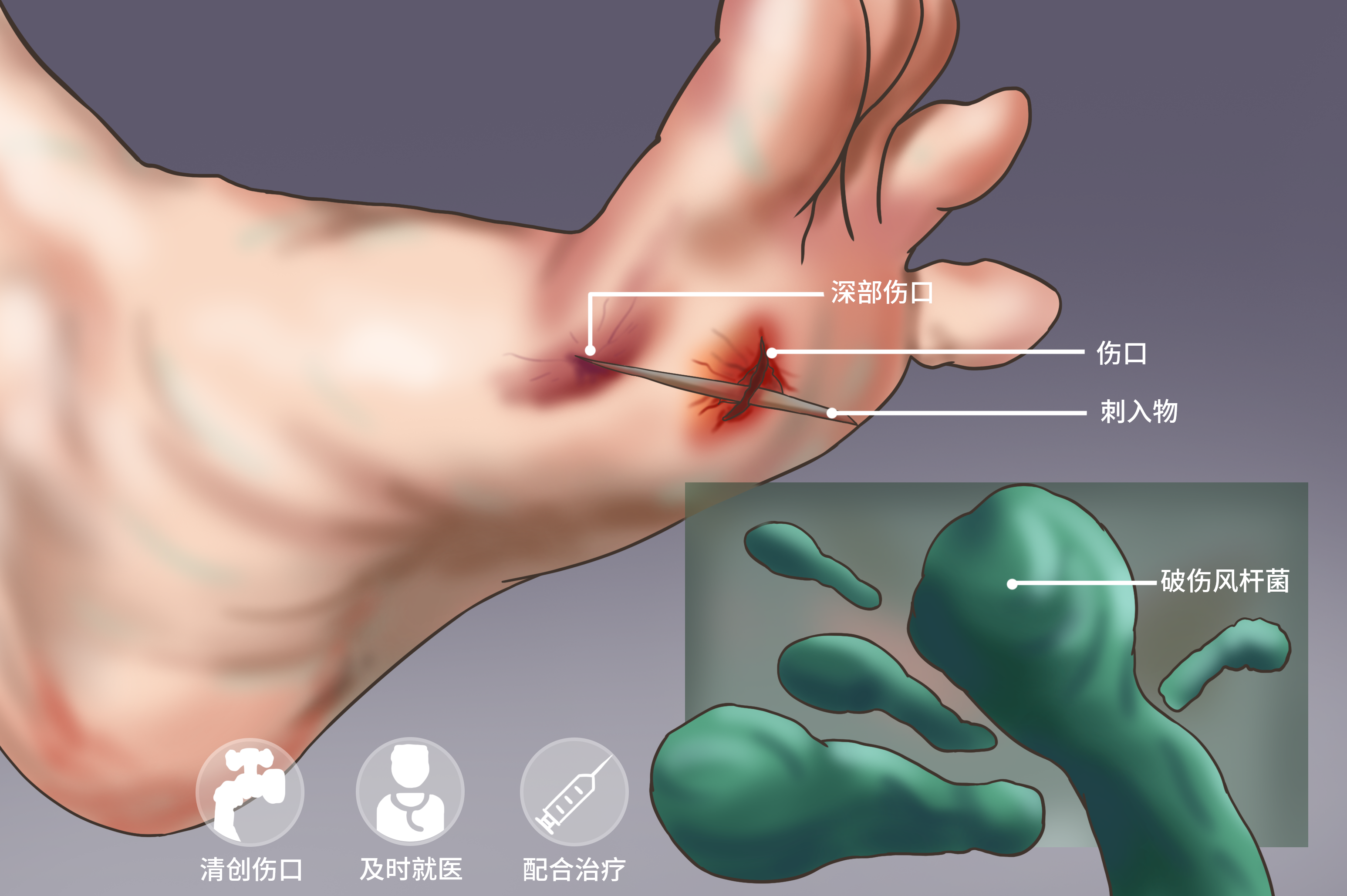 外伤可能会引发破伤风,伤口部位会呈现出皮肤出血,发红,疼痛等症状