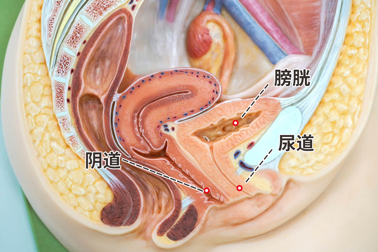 尿道阴道位置图