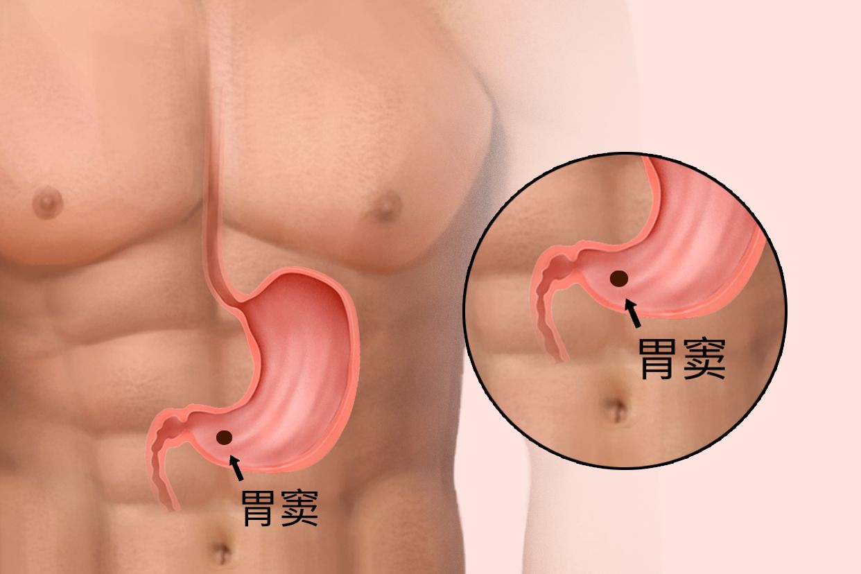 胃窦在肚脐的位置图