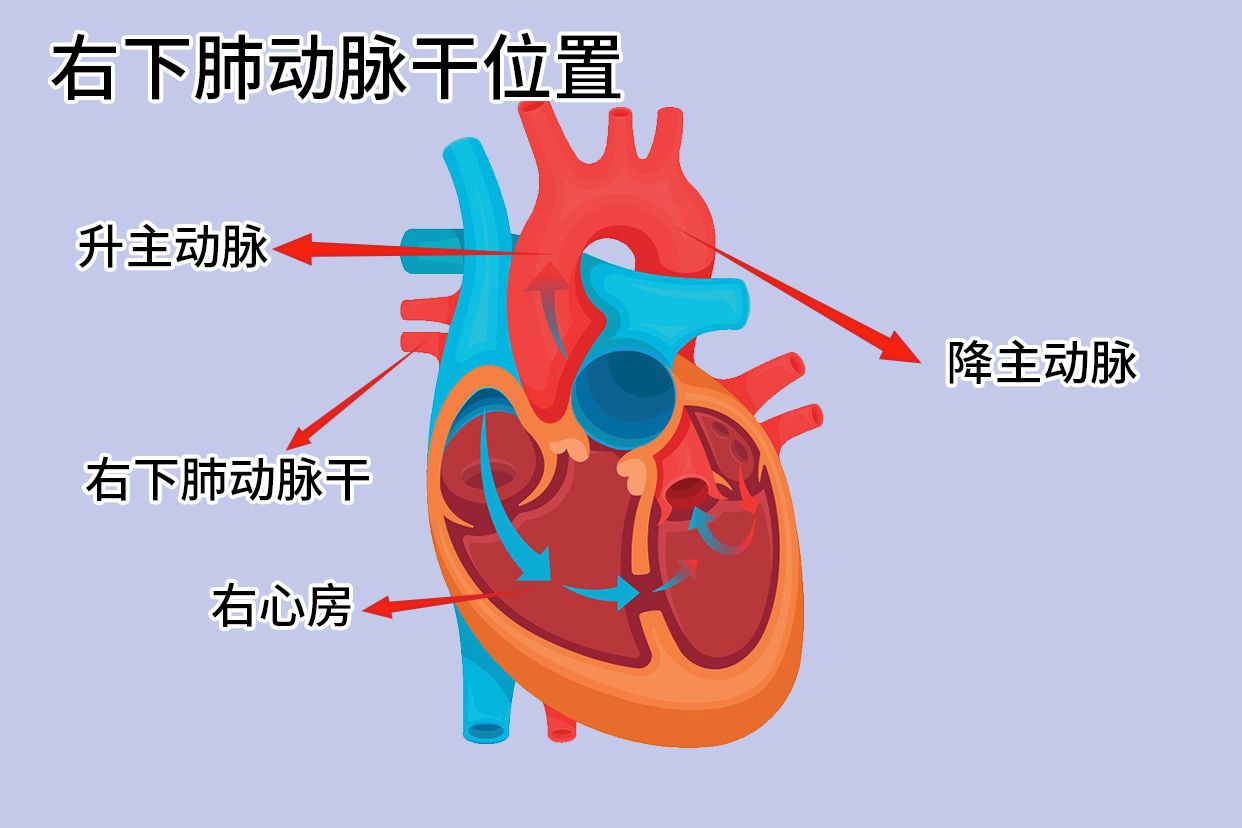 右下肺动脉干位置图片