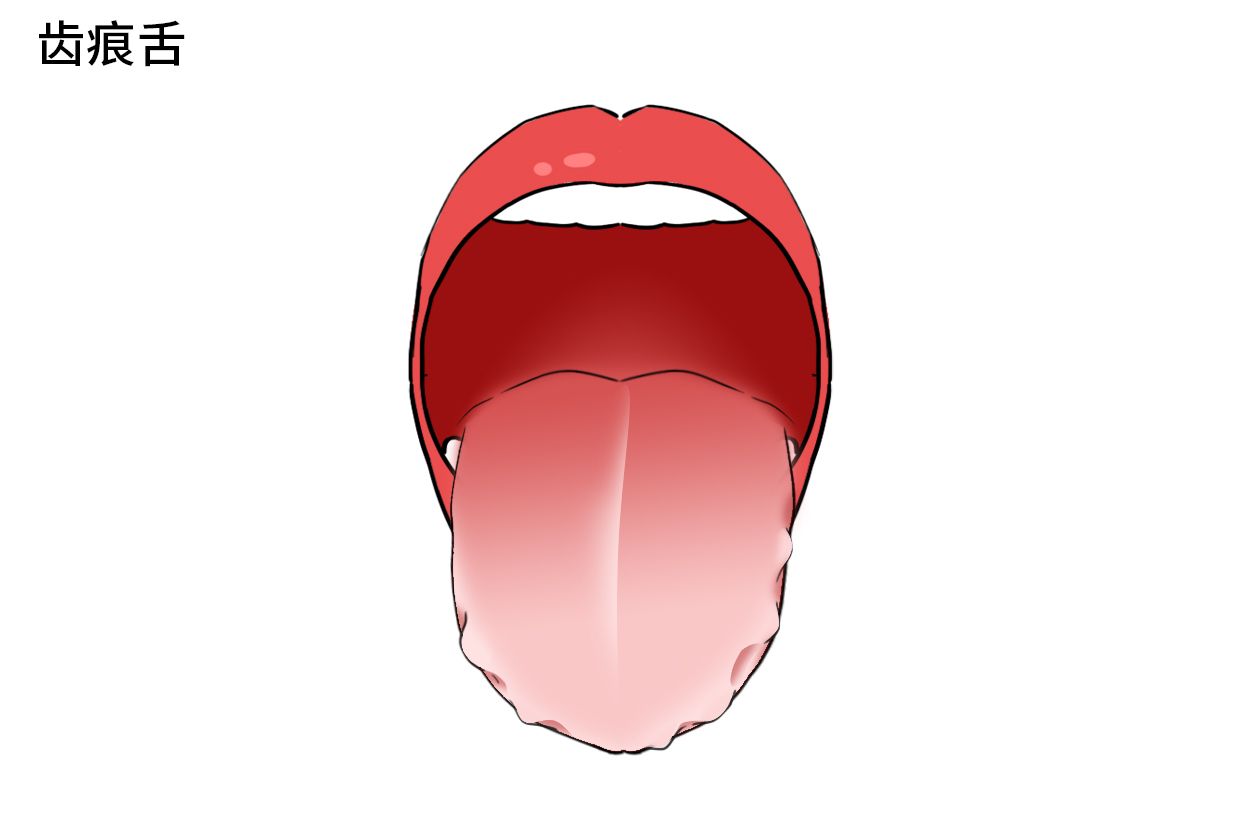 舌苔有轻微锯齿状图片