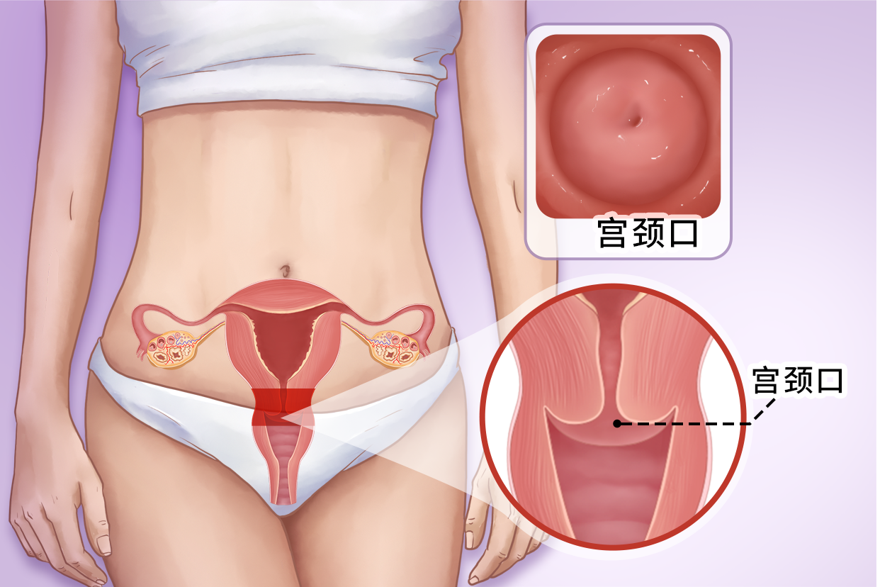 子宫颈图