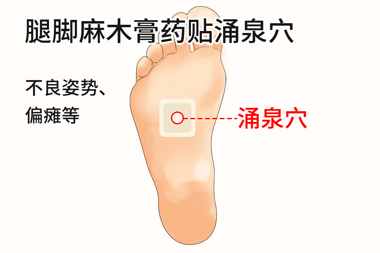 腿脚麻木膏药贴涌泉穴图