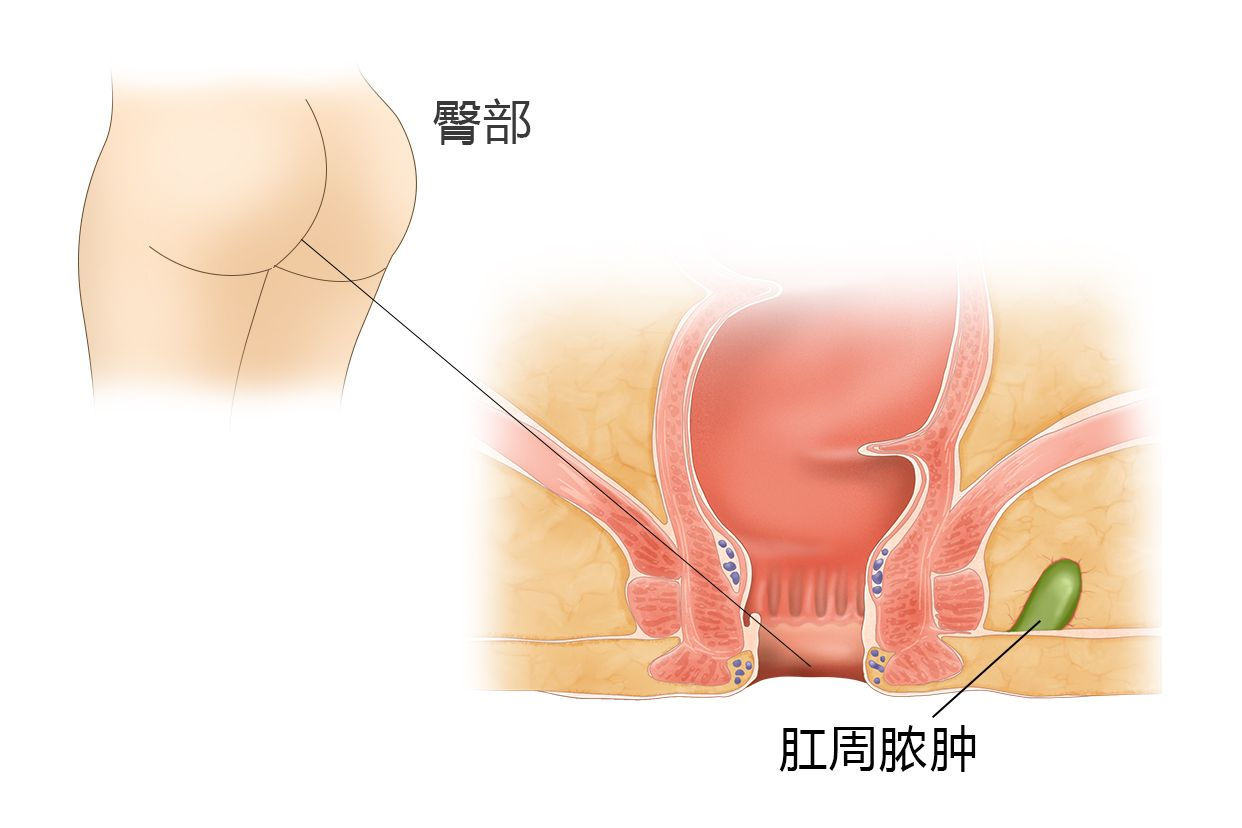 肛门位置图片