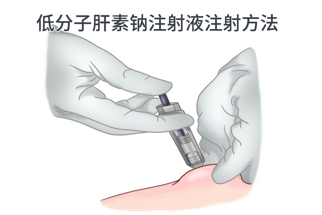 低分子肝素钠注射液注射方法图片