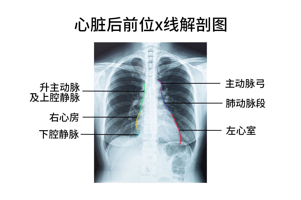 心脏后前位x线图
