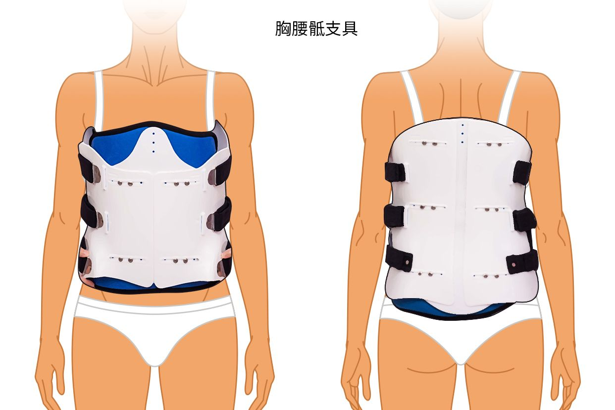 胸腰骶支具图片