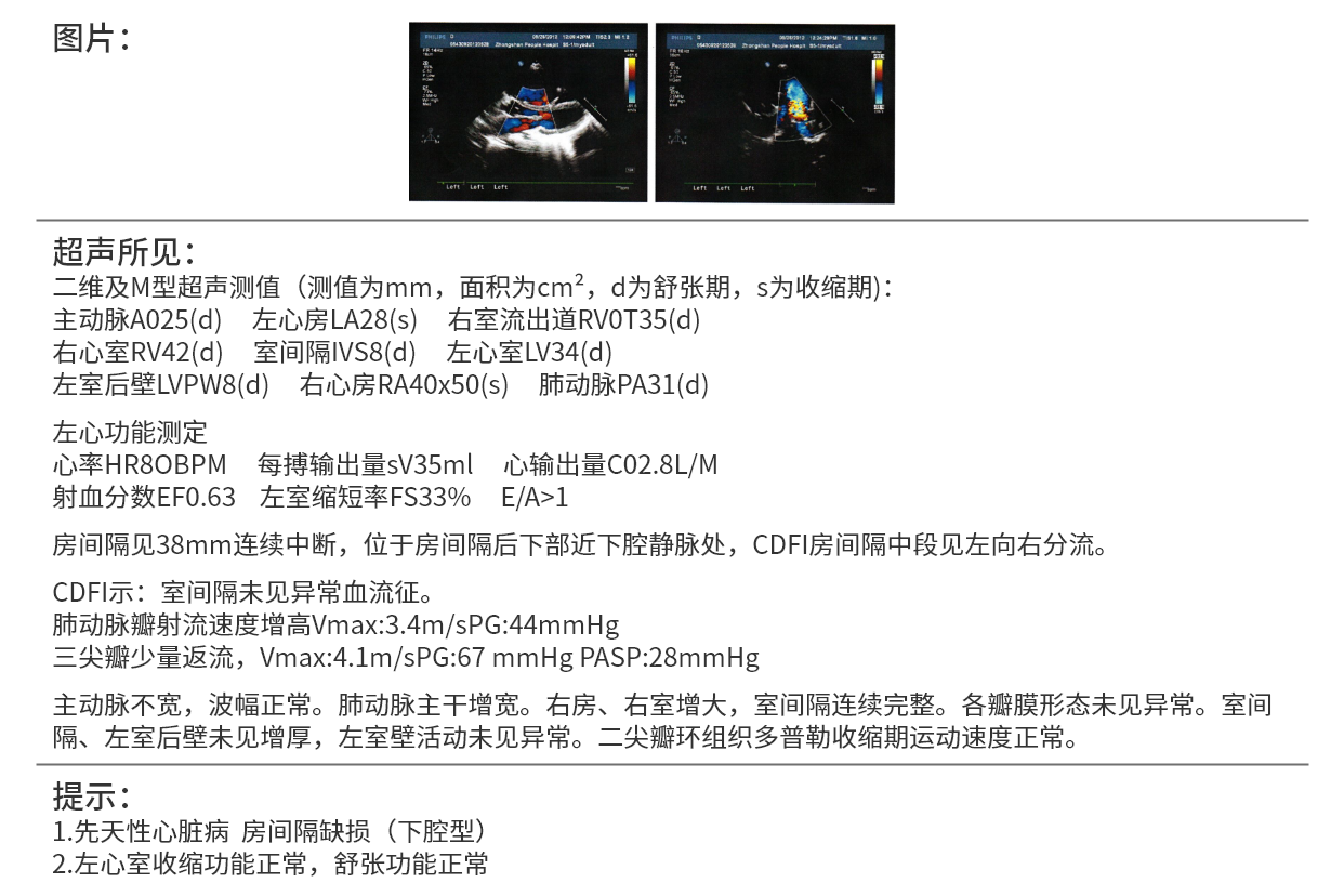 先天性心脏病报告单图