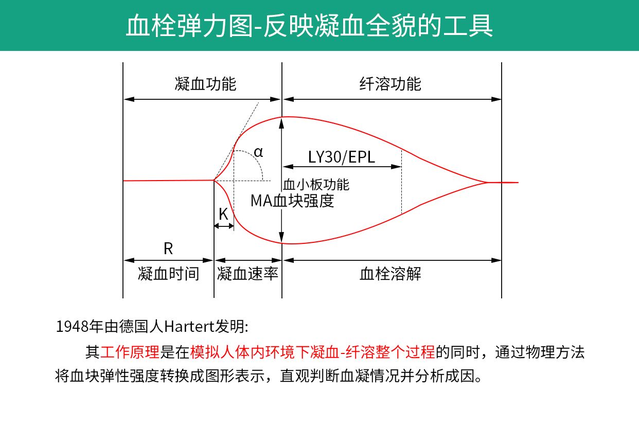 血栓弹力图