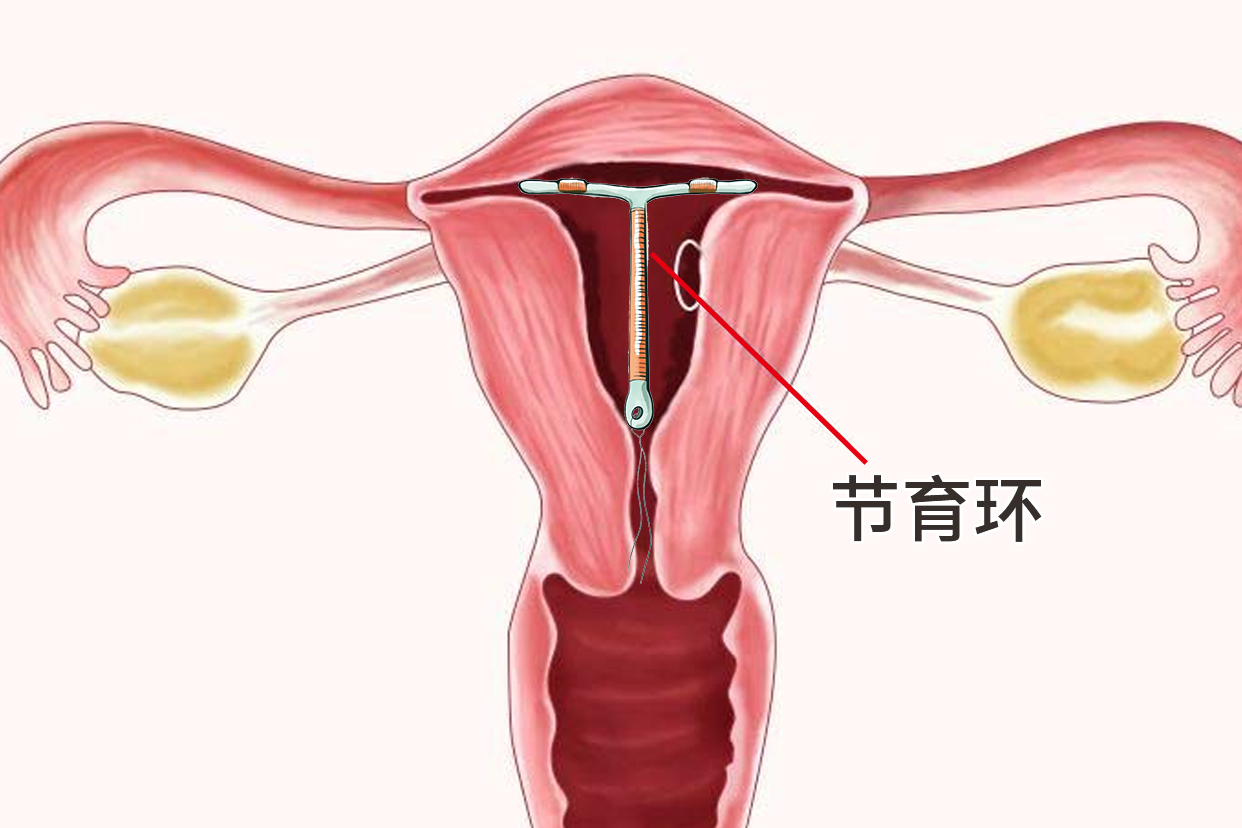 上环子宫图图片