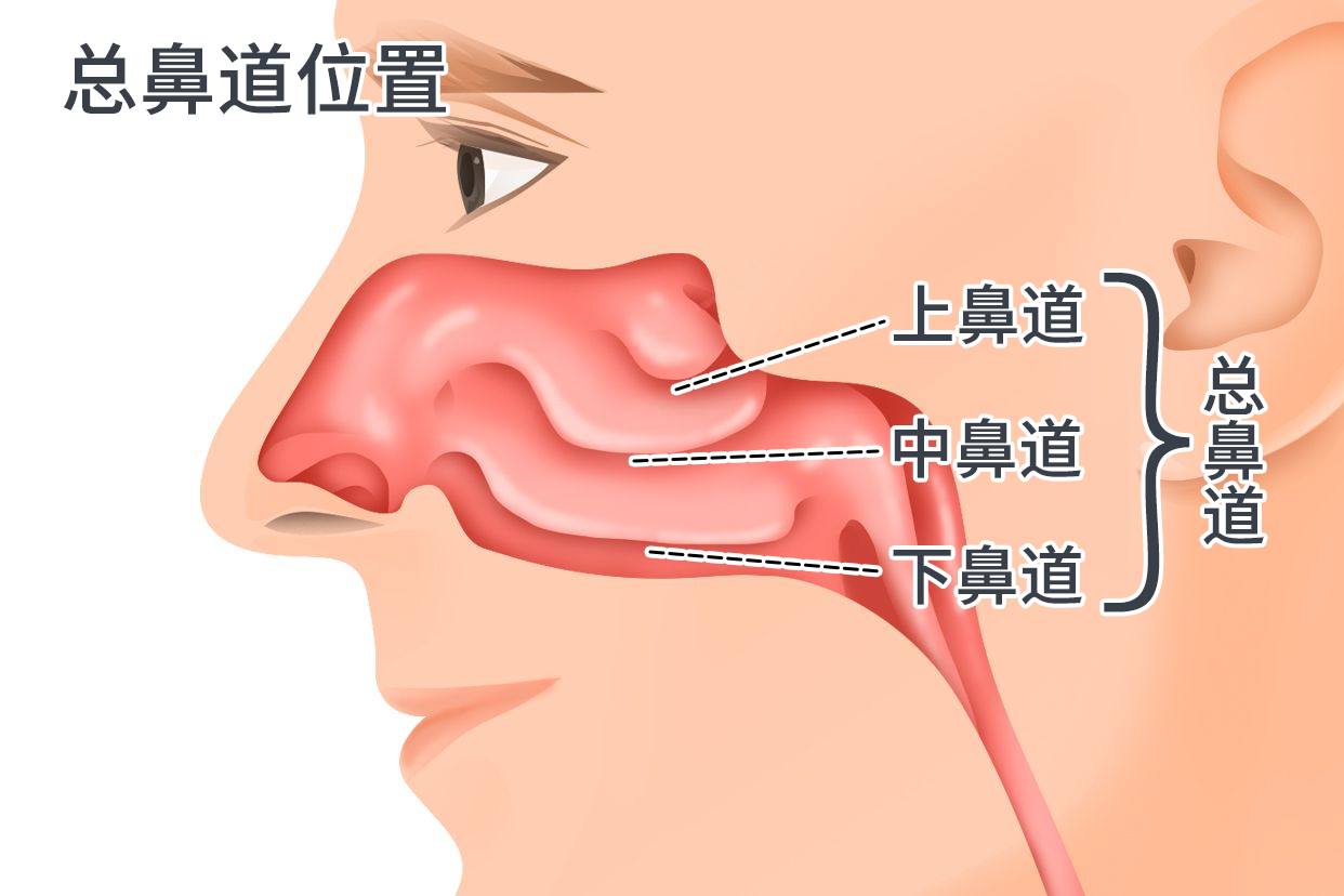 总鼻道位置图