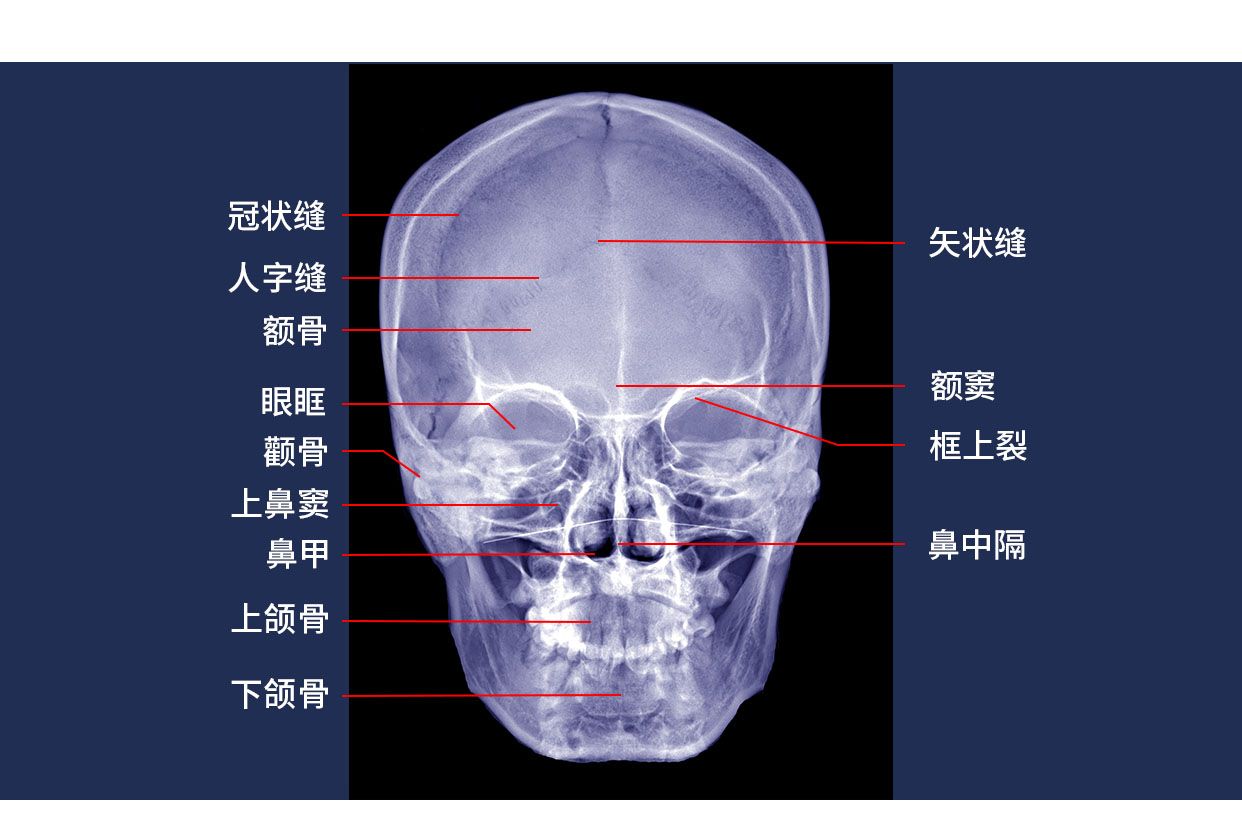 头颅X线图