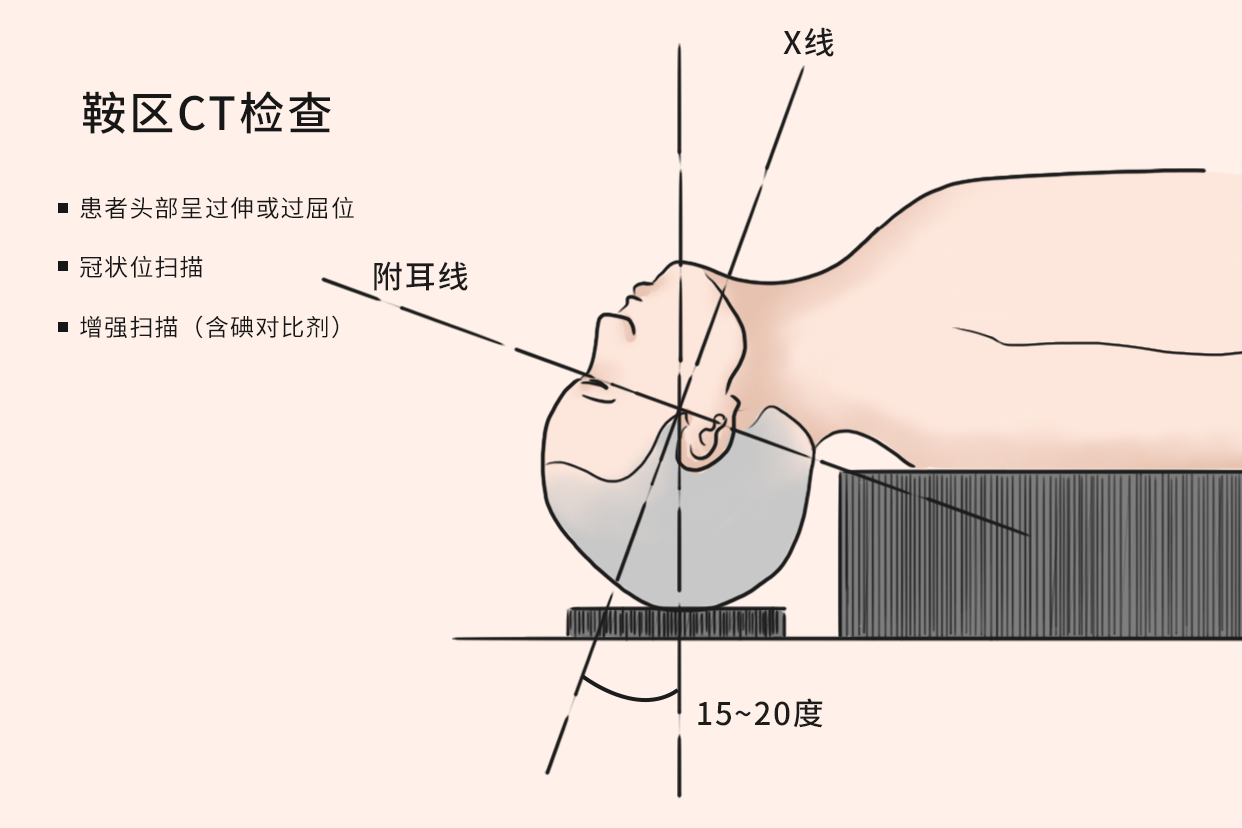 鞍区CT扫描范围图